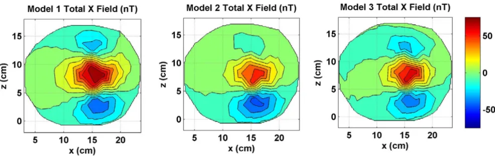 Figure 3Combined x component of the magnetic field of source and volume currents for three modelsCombined x component of the magnetic field of source and volume currents for three models