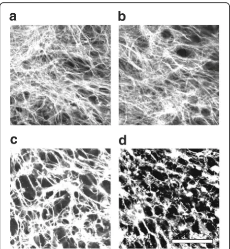 Fig. 6 NMO rAb #53 and HC cause rapid astrocyte network destructionin mouse brain slices