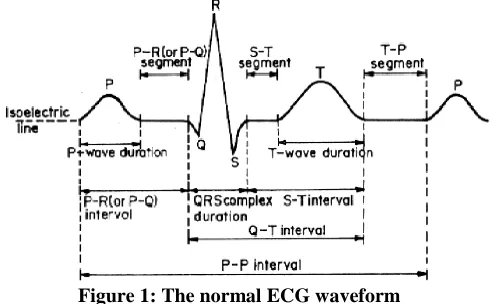 Figure 1: The normal ECG waveform 