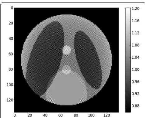 Fig. 5 Result of iterative reconstruction with standard least squares minimization. Contrast was adapted with respect to the center of the image