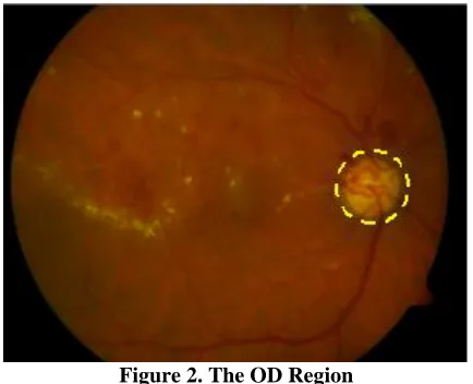Figure 2. The OD Region 