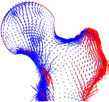 Figure 4One-legged stanceOne-legged stance. The distribution of principal stresses in a model of one-legged stance with spring elements at a prestrain of 5%, a vertical force of body weight applied to the femur and an abductor force of three times body wei