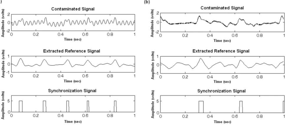 Figure 7QRS detection on contaminated rodent ECGQRS detection on contaminated rodent ECG