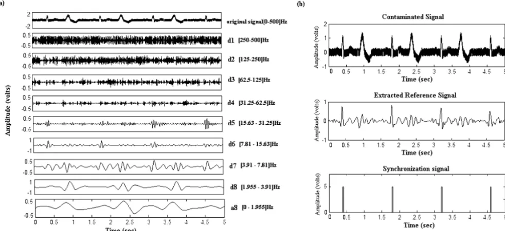 Table 4: Averaged results for each wavelet