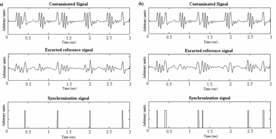 Figure 6Wavelets performances differenceWavelets performances difference. QRS detection for "75 bpm" signal recorded during the IRSE sequence: the same sig-nal is decomposed using coif5 and sym5