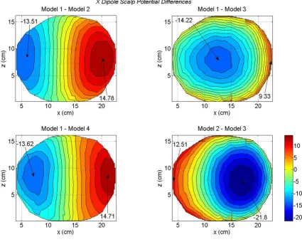 Figure 5Differences in scalp potentials of head models for an x oriented dipole in the motor cortex areaDifferences in scalp potentials of head models for an x oriented dipole in the motor cortex area