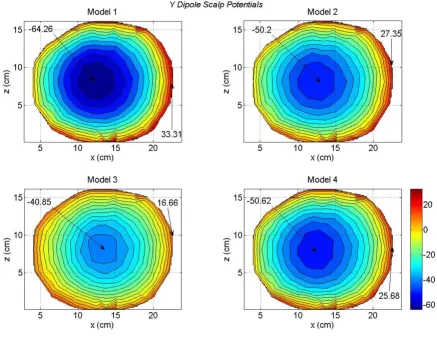 Figure 6Scalp potentials of four head models for a y oriented dipole in the motor cortex areaScalp potentials of four head models for a y oriented dipole in the motor cortex area