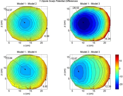 Figure 7Differences in scalp potentials of head models for a y oriented dipole in the motor cortex areaDifferences in scalp potentials of head models for a y oriented dipole in the motor cortex area