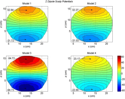 Figure 8Scalp potentials of four head models for a z oriented dipole in the motor cortex areaScalp potentials of four head models for a z oriented dipole in the motor cortex area