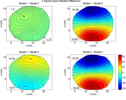 Figure 9Differences in scalp potentials of head models for a z oriented dipole in the motor cortex areaDifferences in scalp potentials of head models for a z oriented dipole in the motor cortex area