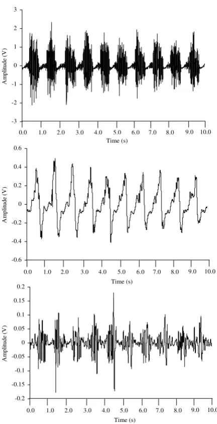 Figure 7Attenuation of movement artifact with digital filteringAttenuation of movement artifact with digital filter-ing