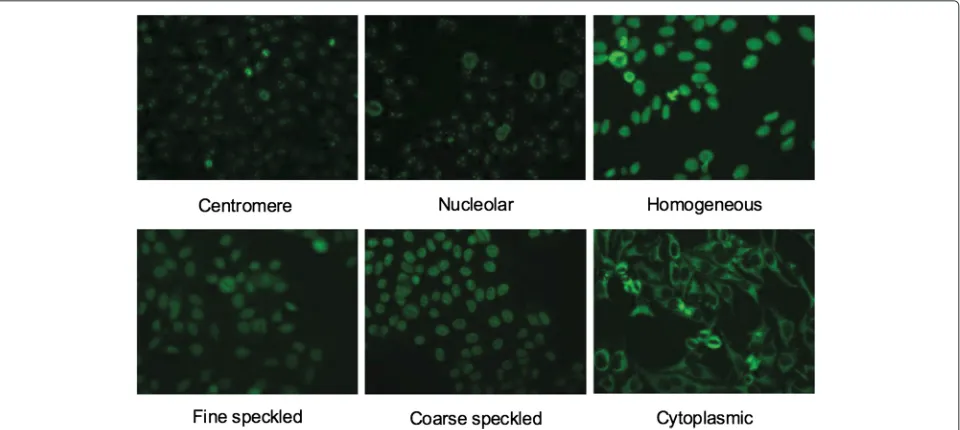 Figure 1 Typical HEp-2 cells with different staining patterns.