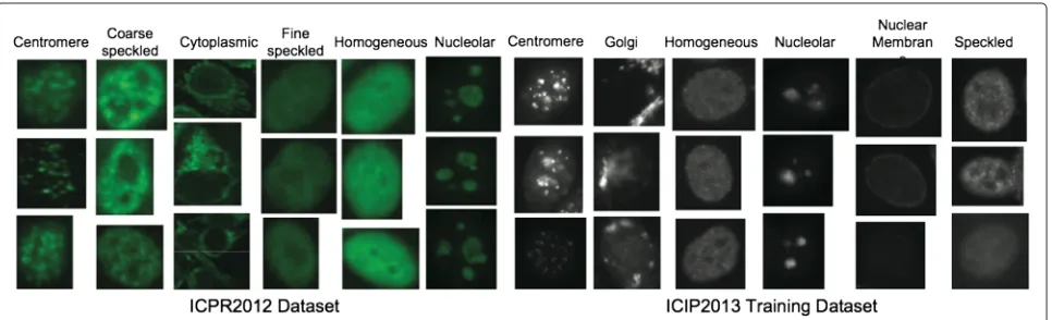 Figure 4 Samples of ICPR 2012 dataset and ICIP 2013 training dataset. With different staining patterns of HEp-2 cells.