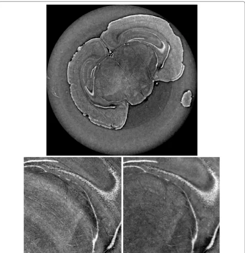 Fig. 6 Slice reconstructed with the proposed custom protocol (dynamic flat fielding, ring removal, projected CTF phase retrieval, and MR-FBP reconstruction)