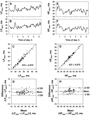 Figure 9Agreement of spectral components of pulse rate variability (PRV) and heart rate variability (HRV)Agreement of spectral components of pulse rate variability (PRV) and heart rate variability (HRV)