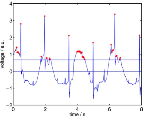 Figure 7applying step 1 of Signal Comparison Algorithm (SCA)ECG signal with relative maxima (indicated by stars left) after ECG signal with relative maxima (indicated by stars left) after applying step 1 of Signal Comparison Algorithm (SCA)