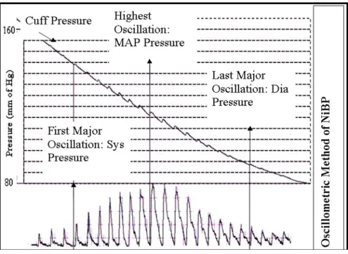 Figure 1Computerized oscillomertryComputerized oscillomertry. Atypical computerized Oscillometric pattern of pressure.