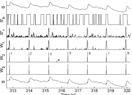 Figure 3Different stages while processing a typical signalinal signal; spikes detected by marks; Different stages while processing a typical signal