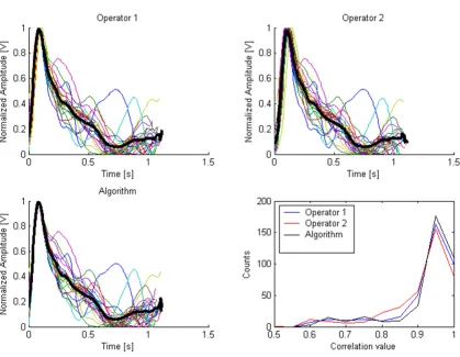 Figure 6Superimposed separated beats (thin colored lines) and one averaged beat (thick black line), from a particular patient, as they were singled out by (A) Operator 1, (B) operator 2 and (C) the algorithm