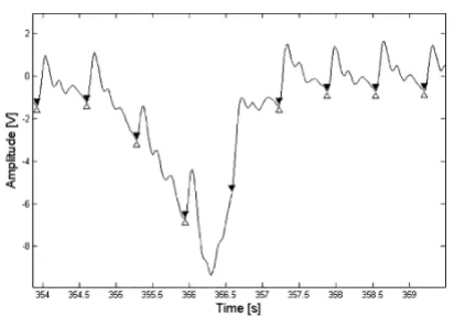 Figure 7Typical case of a beat falsely classified as positive by the rithm. algorithmTypical case of a beat falsely classified as positive by the algo-∆ are the points selected by the operator and ▼ are those detected by the algorithm.