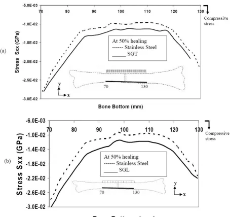 Figure 9stresses for SGL and SSStresses along the bottom of the bone during 50% healing (a) comparison of stresses for SGT and SS (b) comparison of Stresses along the bottom of the bone during 50% healing (a) comparison of stresses for SGT and SS (b) comparison of stresses for SGL and SS.