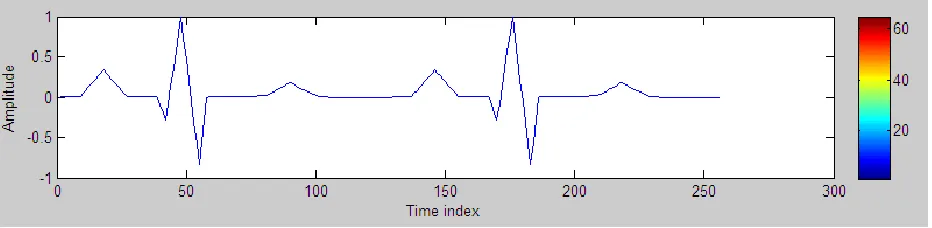 Figure 1(a) shows the original ECG replicate signals, Fig. 1(b) shows the S-transform of the original ECG signal, Fig