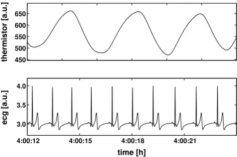 Figure 2Relevant data in the recordingslocal minima in the respiratory trace) derived from the Relevant data in the recordings