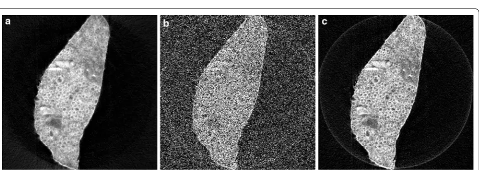 Fig. 9 Reconstructions of a diamond anvil cell experiment with missing projections, using: a the proposed SIRT-FBP method with 100 approxi-mated iterations, b standard gridrec with the Shepp–Logan filter and additional gaussian filtering afterwards, and c standard gridrec with the Parzen filter