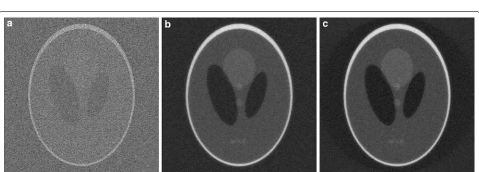 Fig. 3 Line profile of SIRT-FBP reconstructions of the Shepp–Logan head phantom, with and without low-frequency artifact adjustment