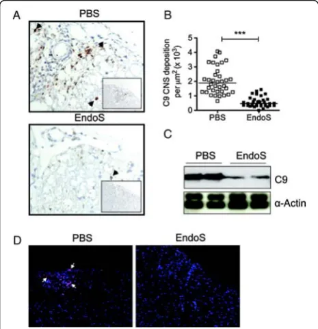 Figure 5 High levels of C9 are detected in the spinal cord ofPBS-treated EAE mouse models, but absent from EAE micetreated with EndoS