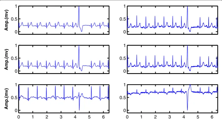 Fig. 8 Shows short-term post-event signals L1–L3 (columnleft column) versus golden standard channels V1–V3 (right )