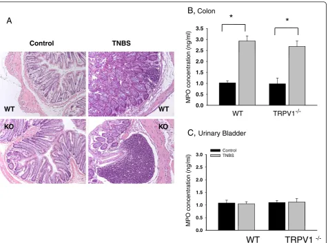 Figure 1 Development of acute inflammation in the distal colon in WT and TRPV1−/− mice