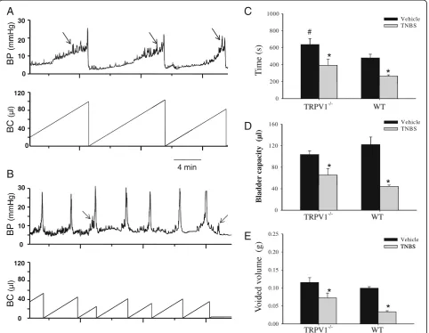 Figure 2 Cystometric evaluation of bladder function before and after the development of a neurogenic bladder