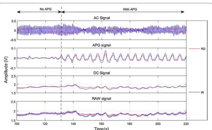 Fig. 6 Baseline PPG signals showing pre APG and post APG phases for Subject 7; top-bottom AC signal, APG signal, DC Signal, and RAW signal