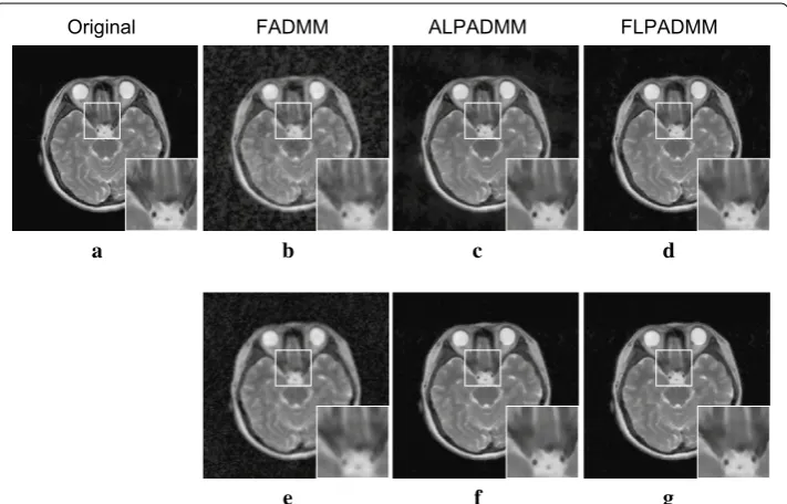 Figure 7MR image reconstruction algorithms, using different sampling masks, when the sam-pling ratios were 0.1, 0.2, 0.3, 0.4, and 0.5, respectively