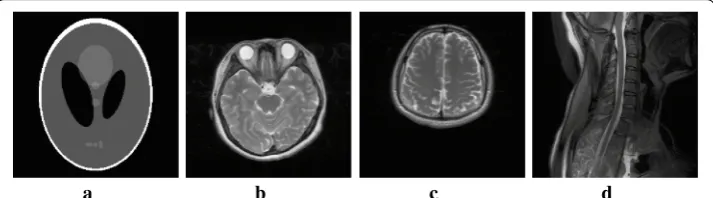 Fig. 2 Sampling masks. a pseudo-Gaussian mask at 15% sampling rate, b pseudo-radial mask at 18% sam-pling rate