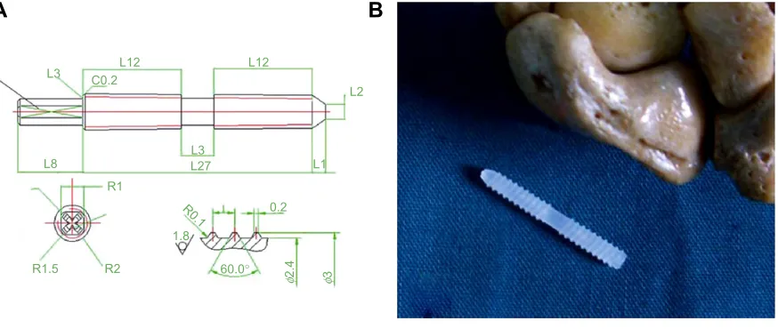 Figure 1 ass design.Notes: (A) ass parameters. (B) side-by-side comparison to show the actual ass size