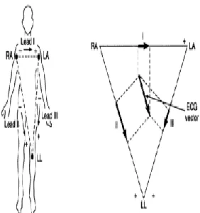Fig. 1.3.  1.2 Effects of Artifacts on ECC Recordings 