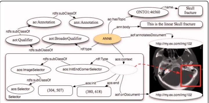 Figure 6 Annotation of a portion of an MRI image, using aot:BroadQualifier.