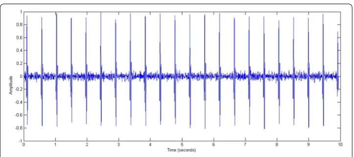 Fig. 11 A portion of a normalized ECG representing a regular beat rate