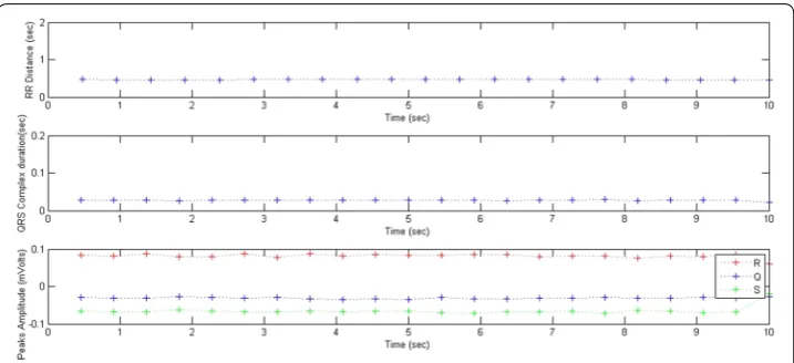 Fig. 12 RR distances, QRS durations and peaks amplitudes variations; σQRS RR = 0.46, σRR = 0.00, QRS = 0.02, = 0.00