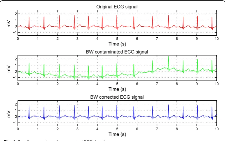 Fig. 4 Baseline wander noise corrected ECG signal
