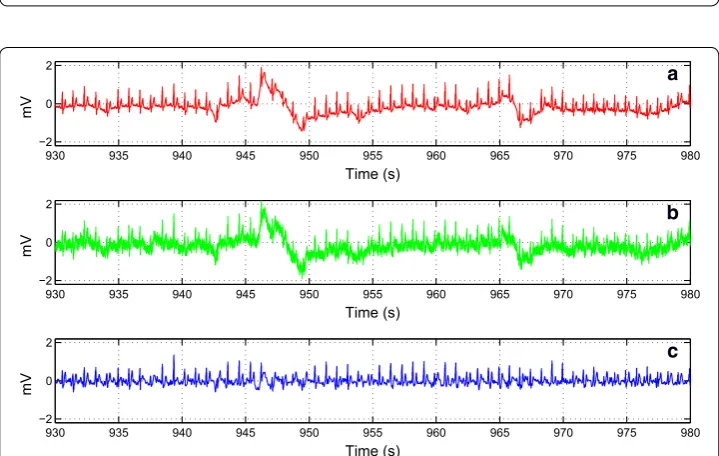 Fig. 10 The de-noising result of the record no. 119 collected from the MIT-BIH Arrhythmia database