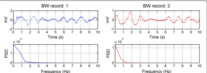 Fig. 3 The corresponding power spectrum of the two ‘bw’ records of length 10 s from the noise stress test database