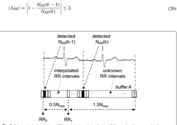 Fig. 6 Schematic representation of RR interval interpolation for the LP filter realized by a cascade of two Lynn’s filters with knots between QRS complexes