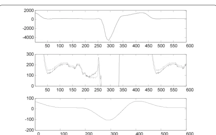 Fig. 7 Histogram of errors after filtering with HP filter with attenuation −0.5 dB at cut-off frequency equal to heart frequency