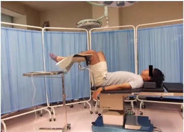 Figure 1 lithotomy position.Note: The subject’s left knee and lower leg were placed on a Big-MaT2000P3Bs® sheet spread over a Knee Crutch®.