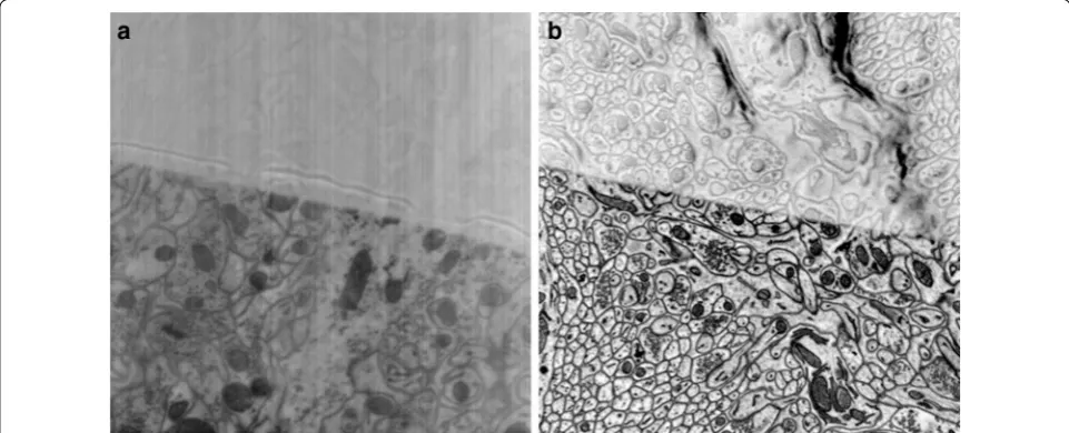 Fig. 7 Comparison of two images of a cerebellum block with a 30-nm-thick blank plastic overlay acquired with 1.5-keV probe-beam-landing energy