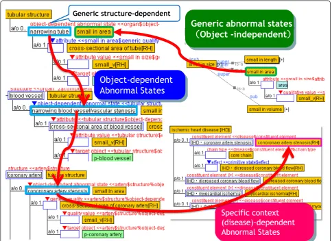 Figure 6 A visual editing tool for causal chains to define disease concepts. This is a screenshot of our visual editing tool for editing thedefinition of disease concepts
