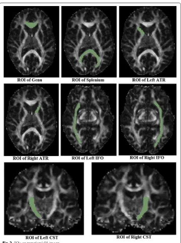 Fig. 2 ROIs on template’s FA image